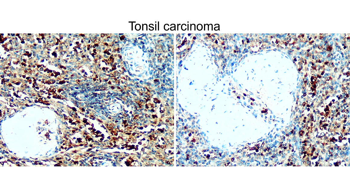 BAX Antibody