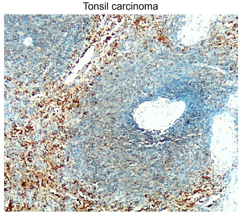 BAX Antibody