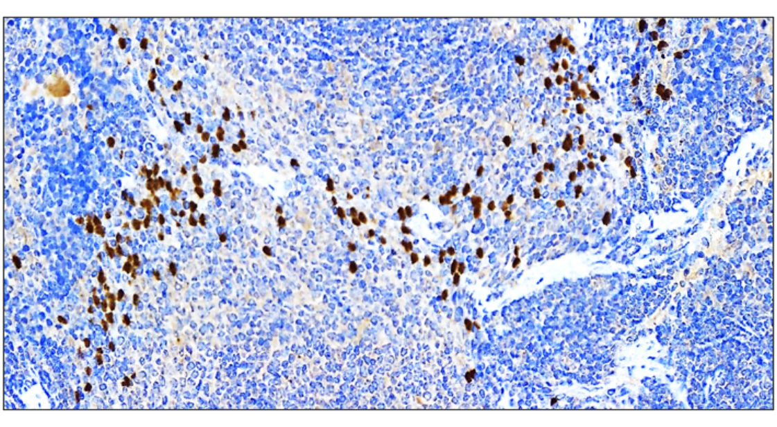 SQSTM1 antibody