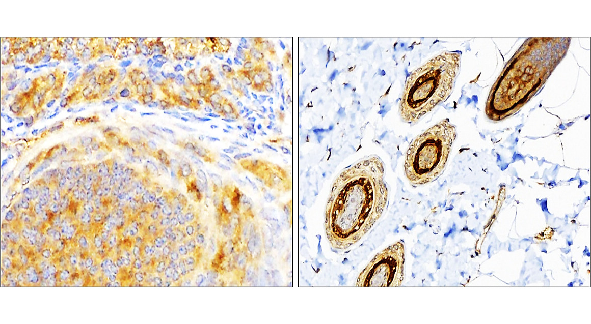 SQSTM1 antibody