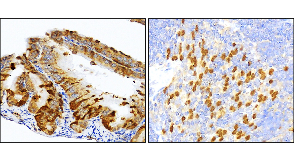 SQSTM1 antibody