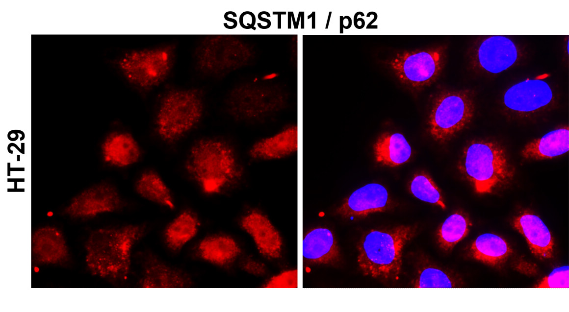 SQSTM1 antibody