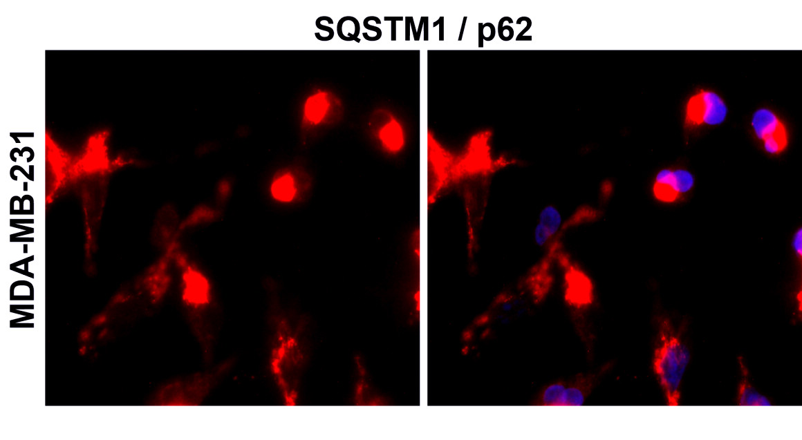 SQSTM1 antibody