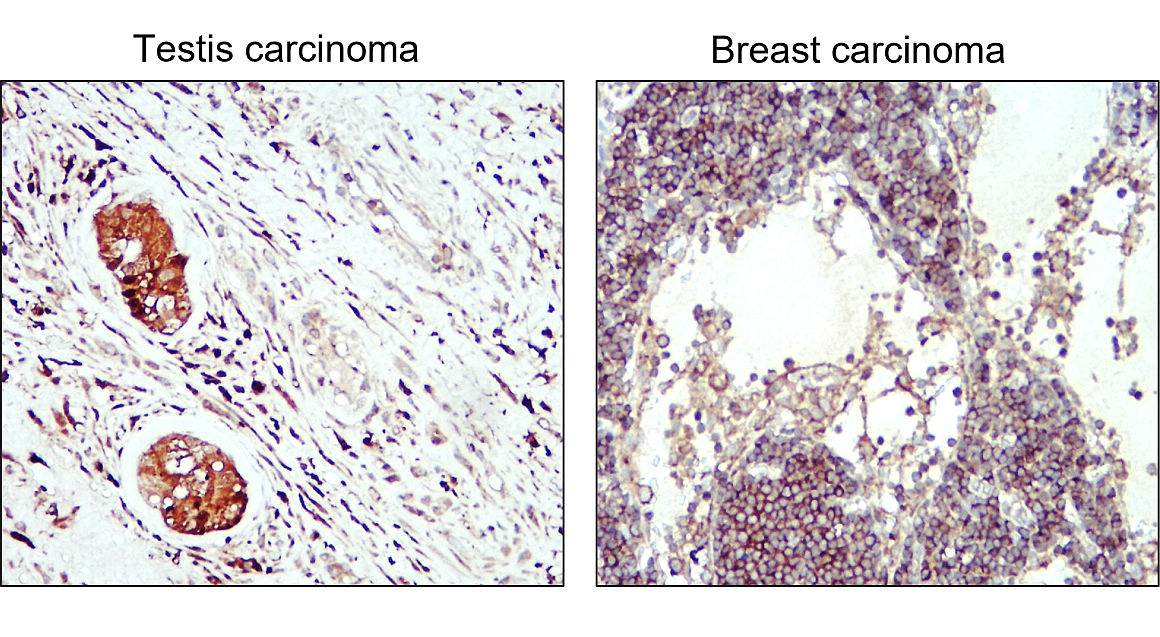 LC3B Antibody