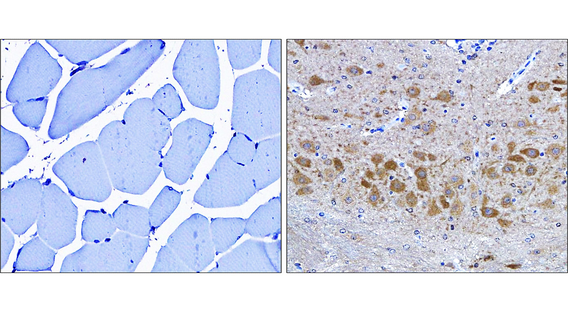 LC3B Antibody