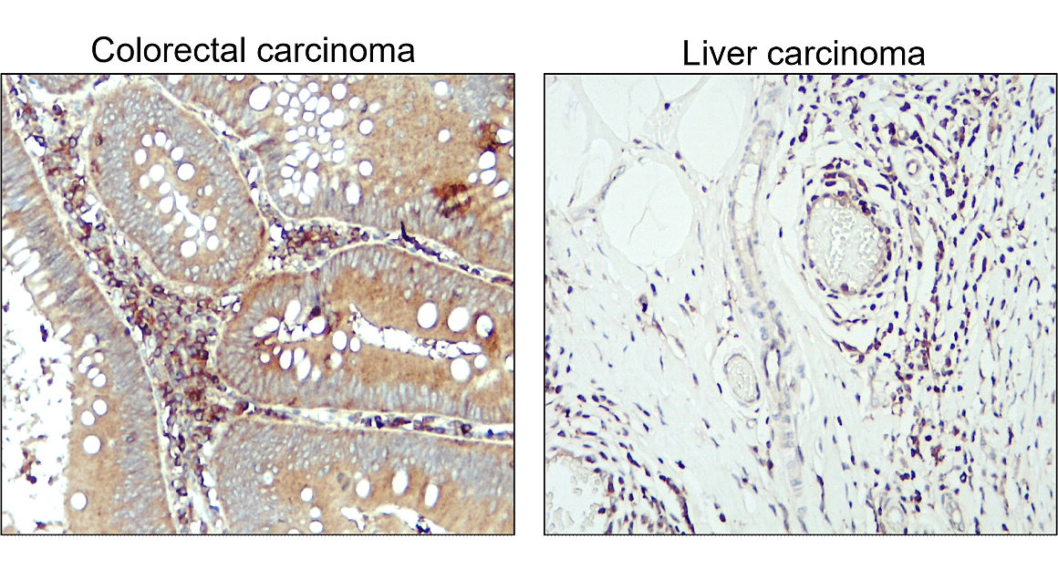 LC3B Antibody