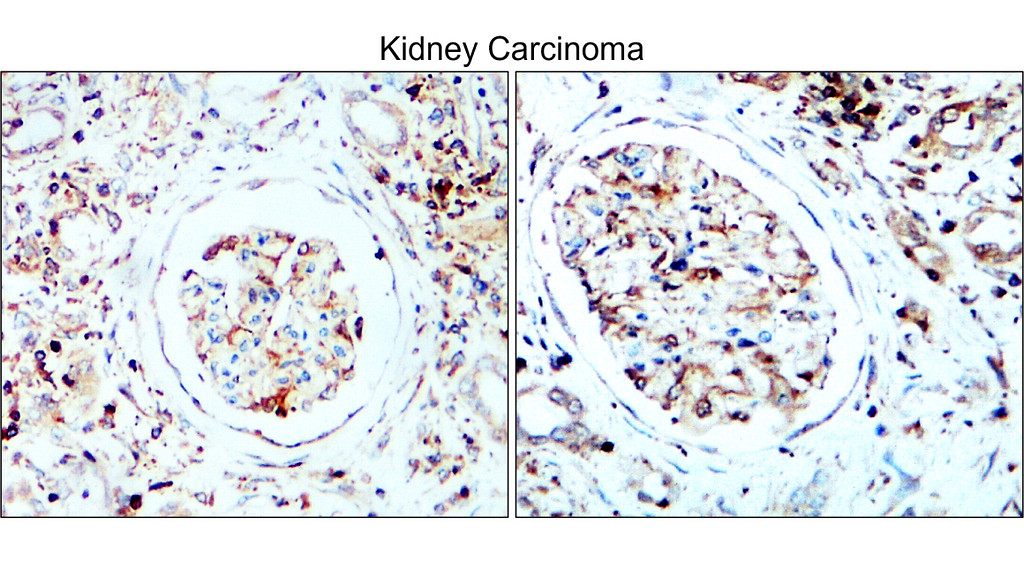 LC3B Antibody