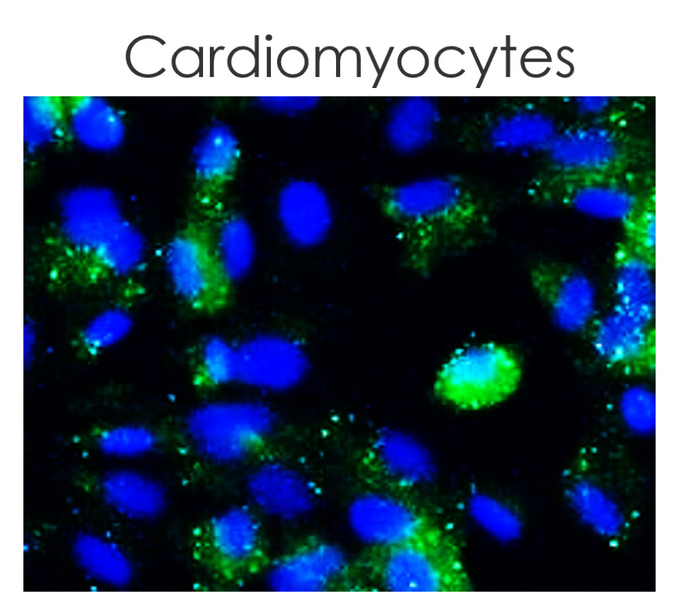 LC3B Antibody