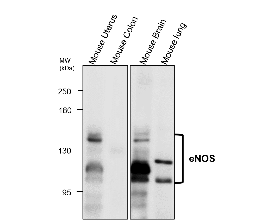 eNOS/NOS3 Antibody