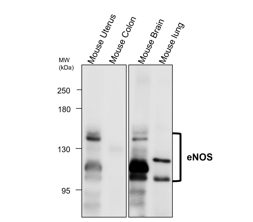 eNOS / NOS3