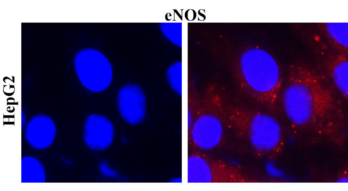 eNOS/NOS3 Antibody