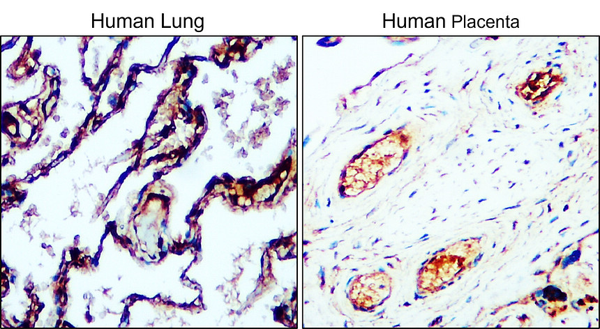 VEGFR2/KDR/CD309 Antibody