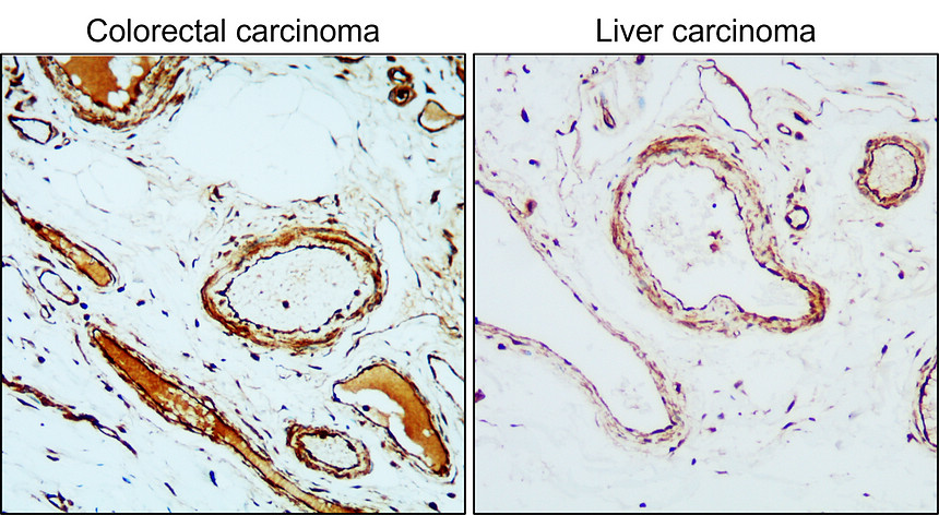 VEGFR2/KDR/CD309 Antibody