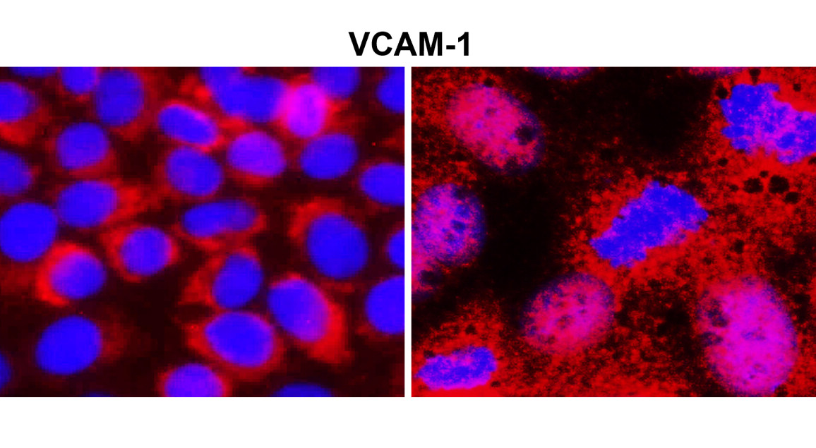 VCAM-1 / CD106 (Extracellular)