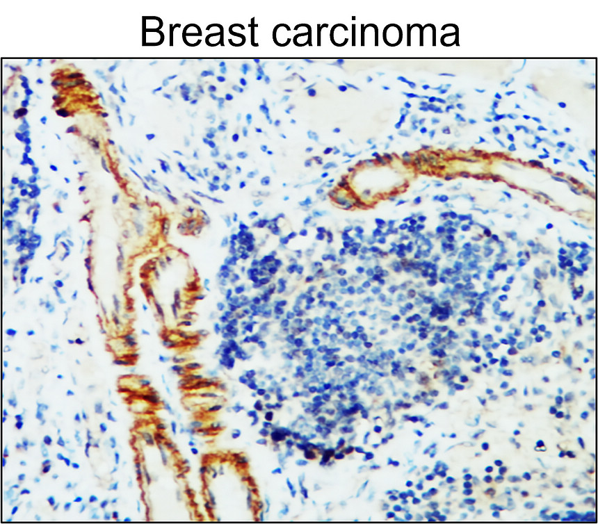 VCAM-1 / CD106 (Extracellular)