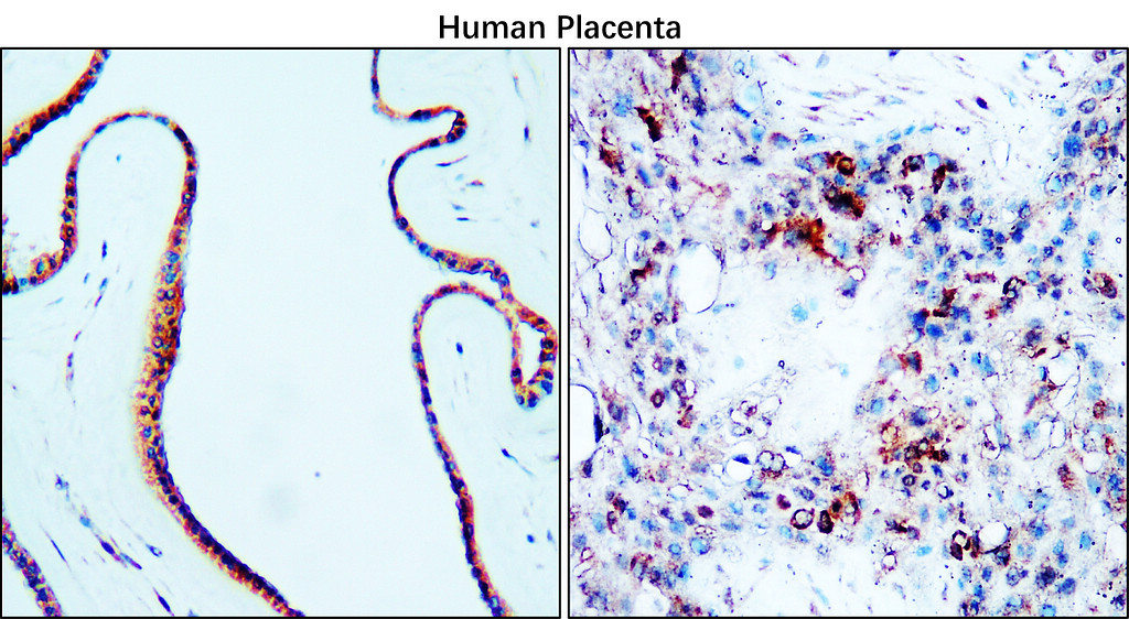 VCAM-1 / CD106 (Extracellular)