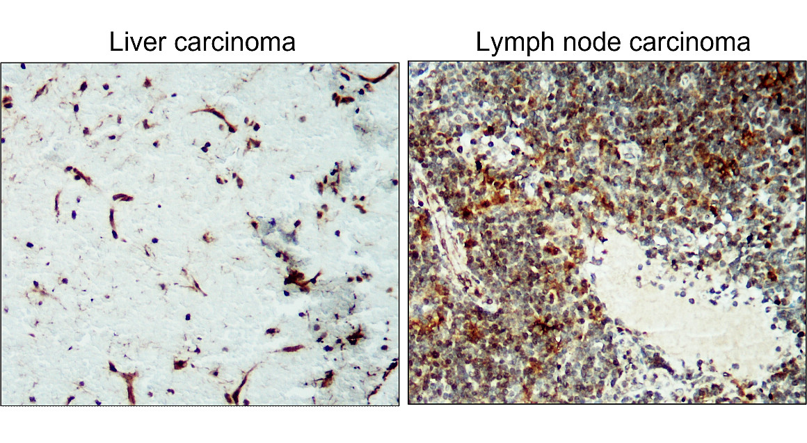 ICAM-1 / CD54 (Extracellular)