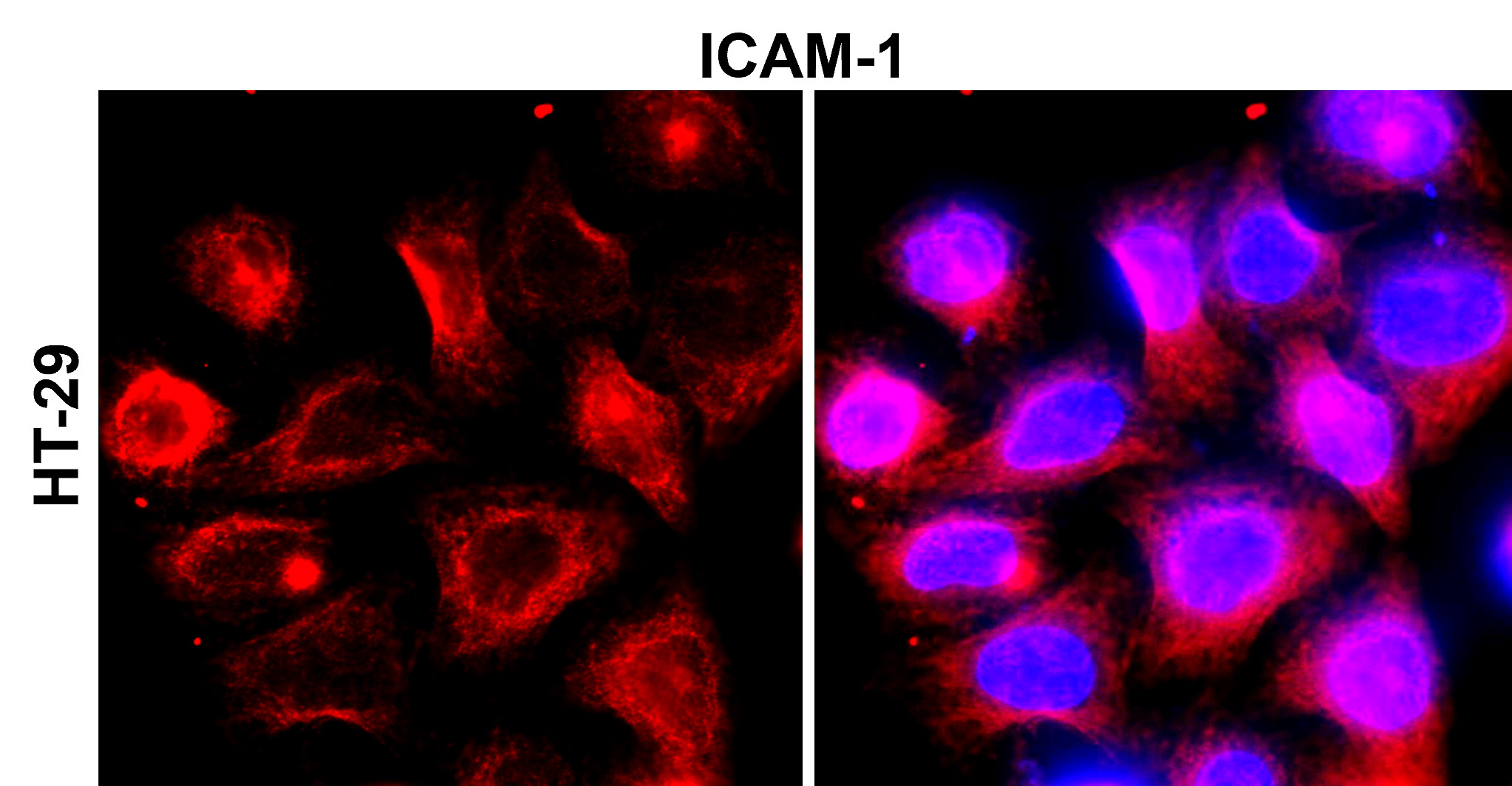 ICAM-1 antibody