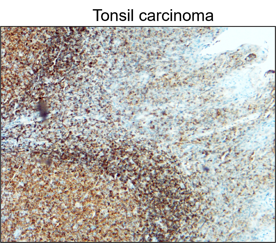 CD45 (Intracellular domain) antibody