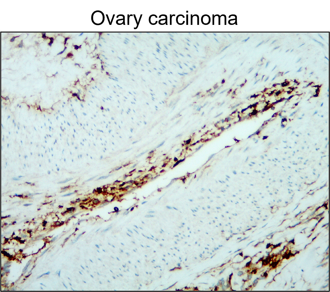 CD45 (Intracellular domain) antibody