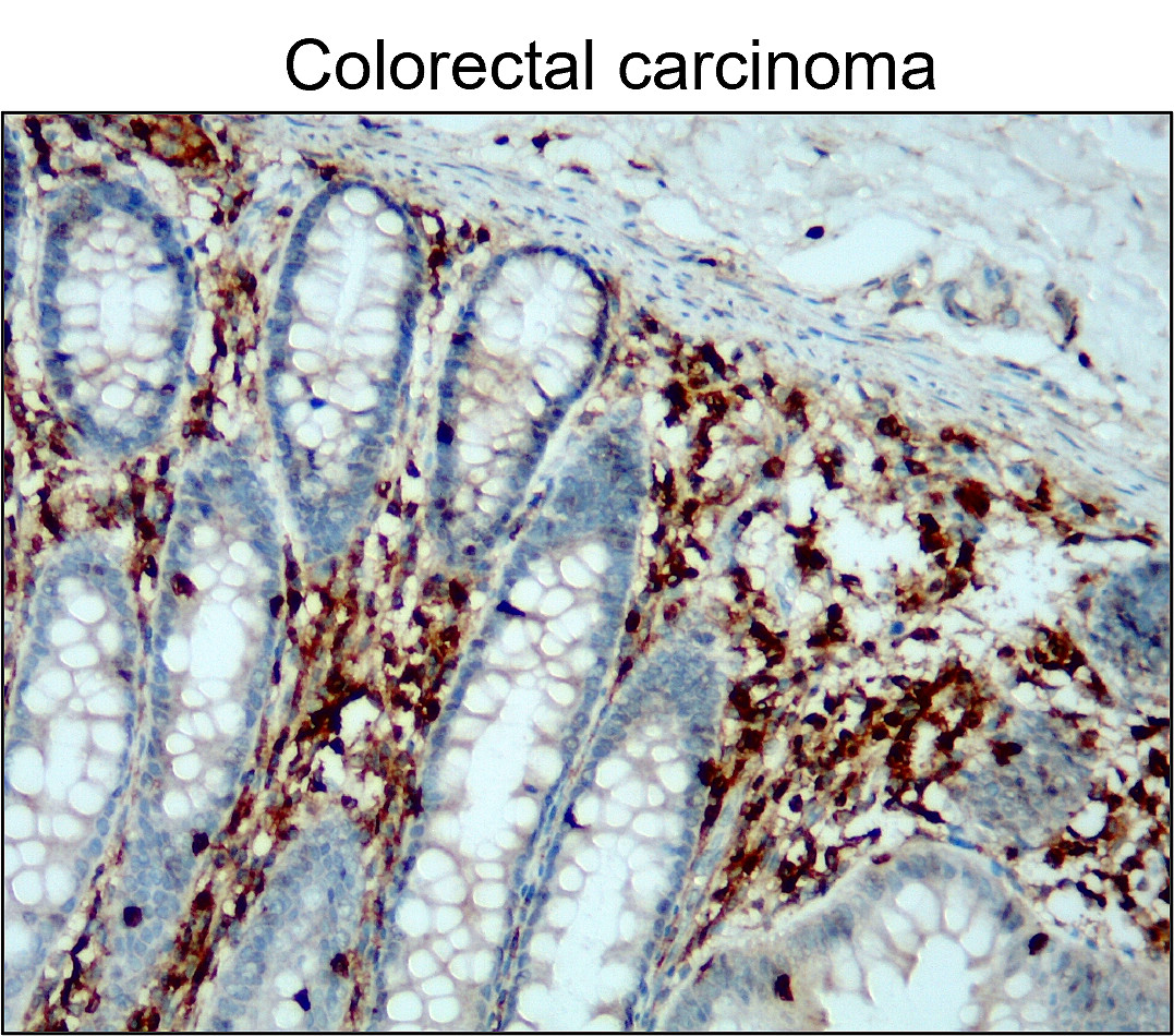 CD45 (Intracellular domain) antibody