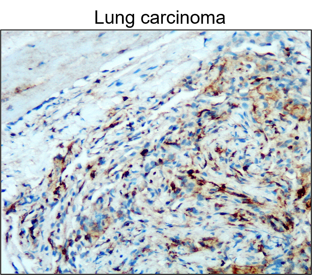 CD45 (Intracellular domain) antibody