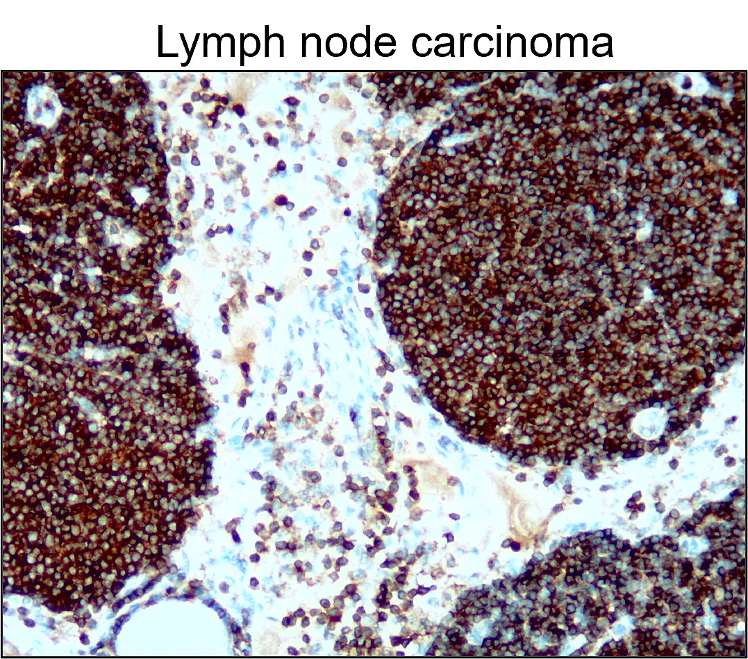 CD45 (Intracellular domain) antibody