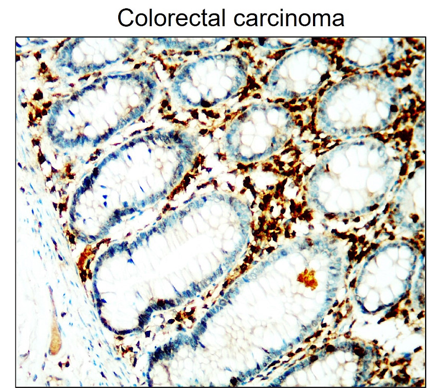 CD45 (Extracellular domain) antibody