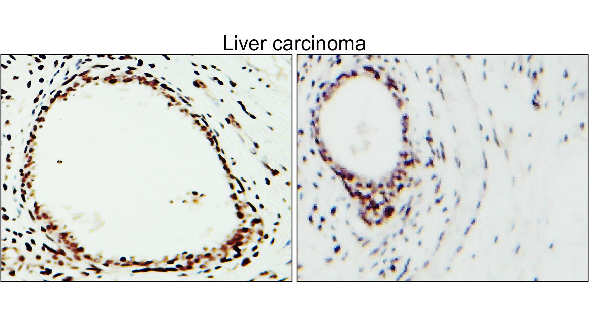 CD31 / PECAM1 (Extracellular)