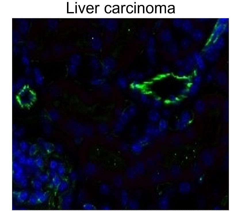 CD31 / PECAM1 (Extracellular)