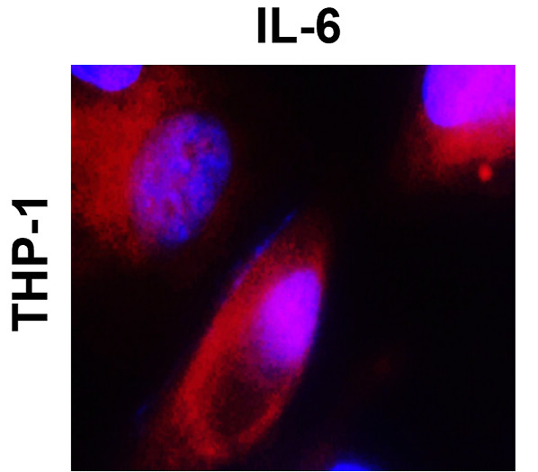 IL-6 Antibody