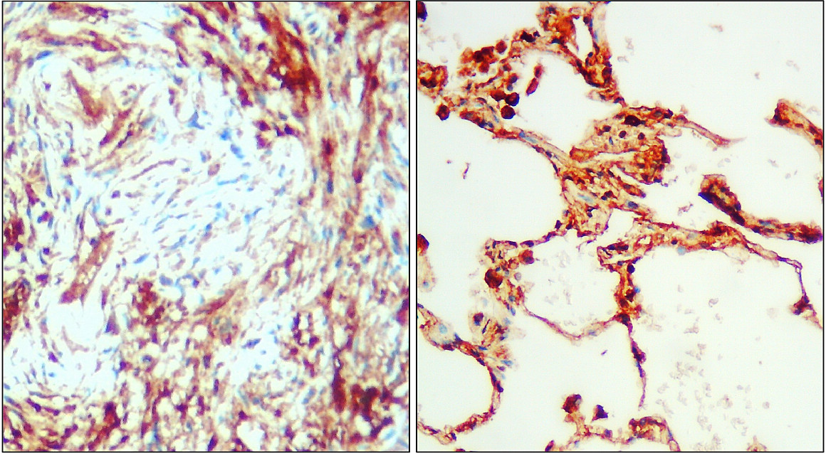 IL-6 Antibody