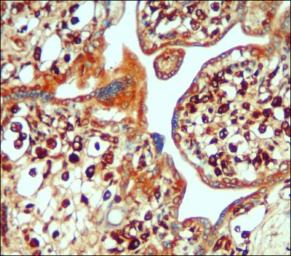 IL-6 Antibody