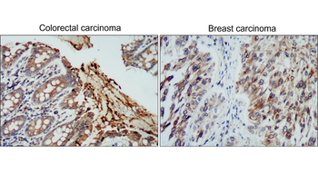 TIMP1 Rabbit Polyclonal Antibody