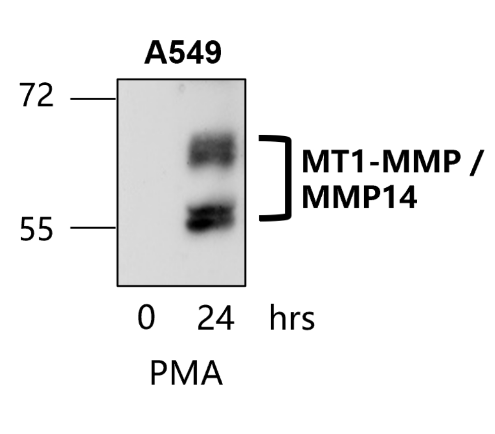 MMP14 antibody