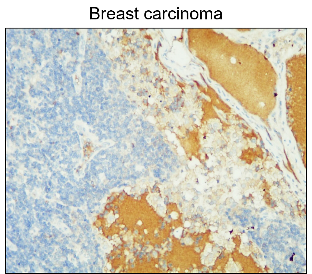 MMP14 antibody