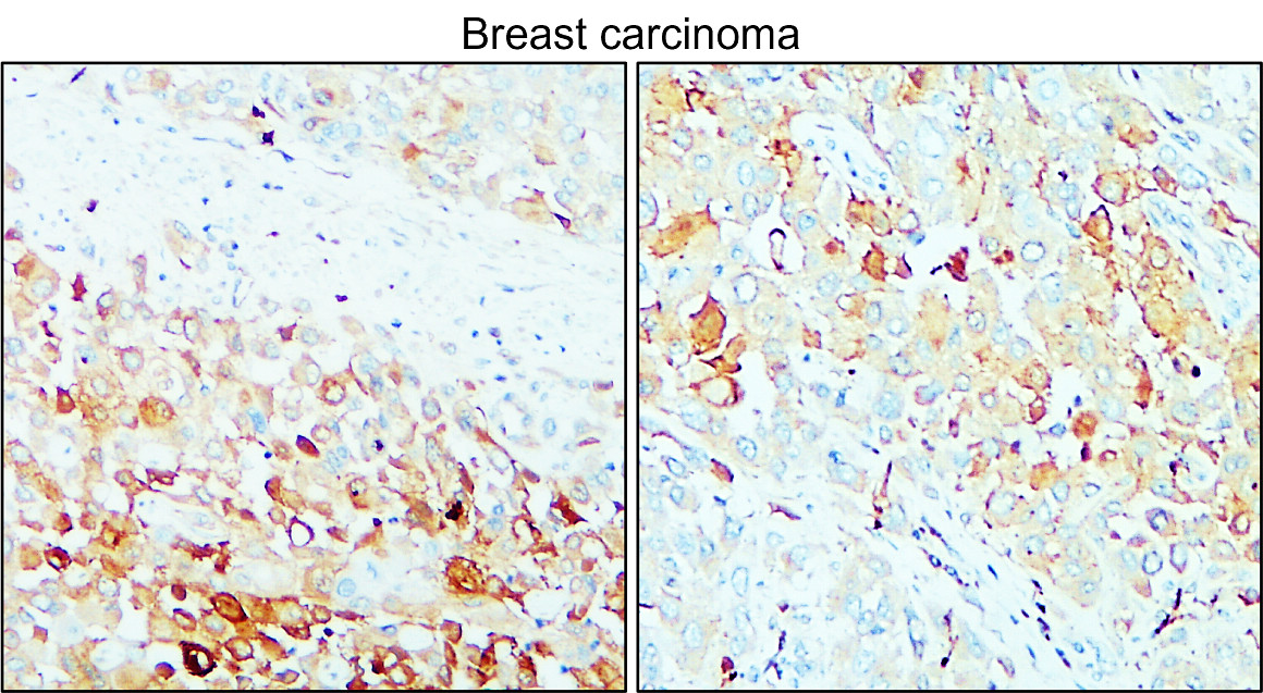 MMP14 antibody