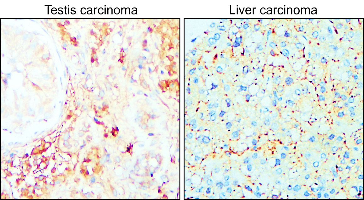 MMP14 antibody