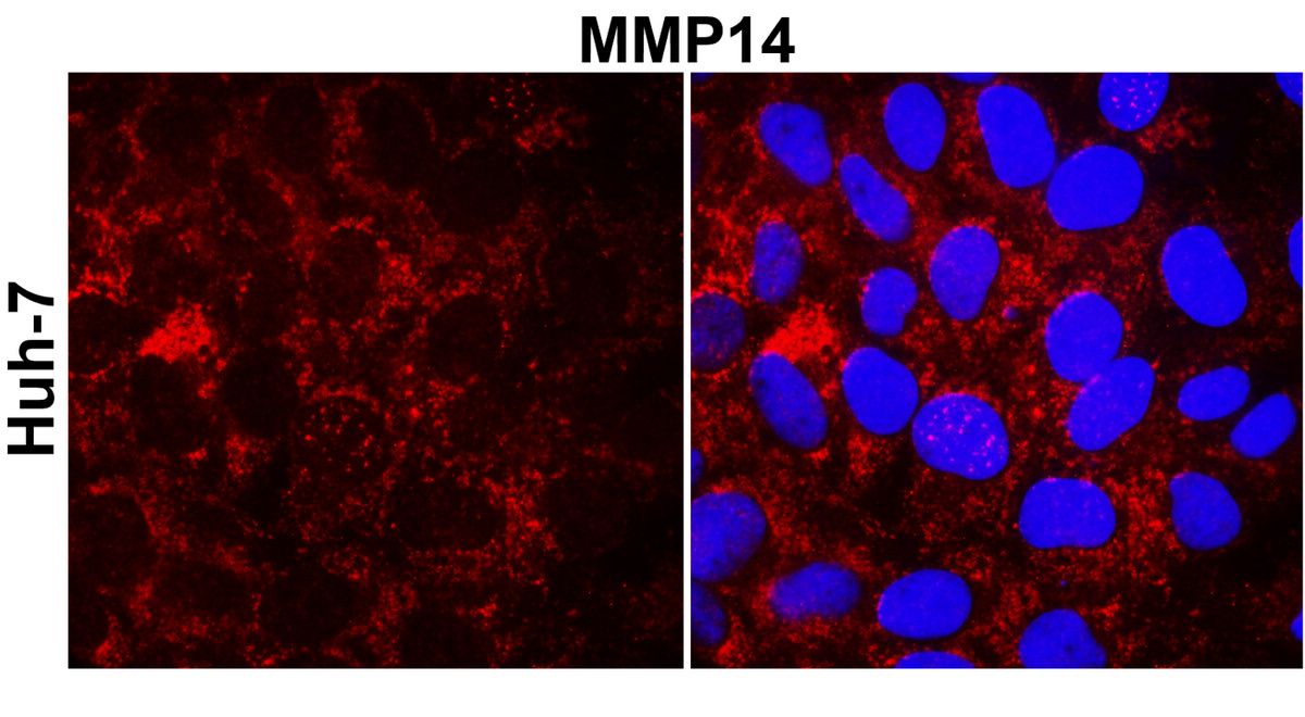 MMP14 antibody