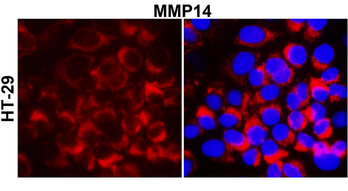 MMP14 antibody