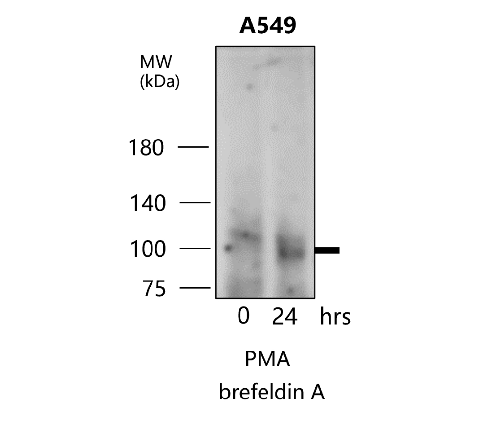 MMP9 Antibody