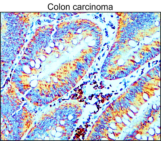 MMP9 Antibody