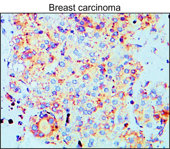 MMP9 Antibody