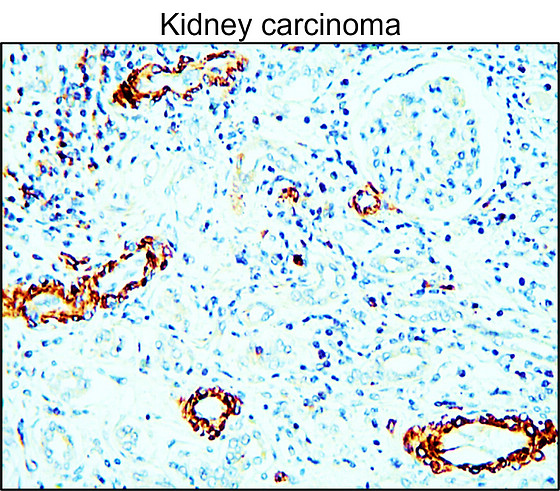 MMP9 Antibody