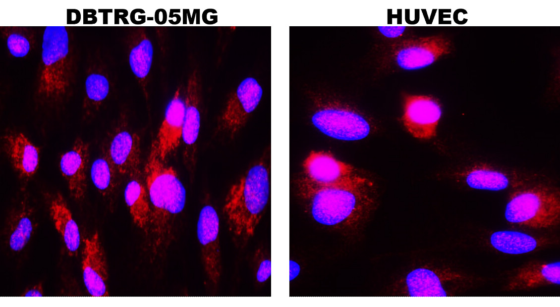 MMP9 Antibody