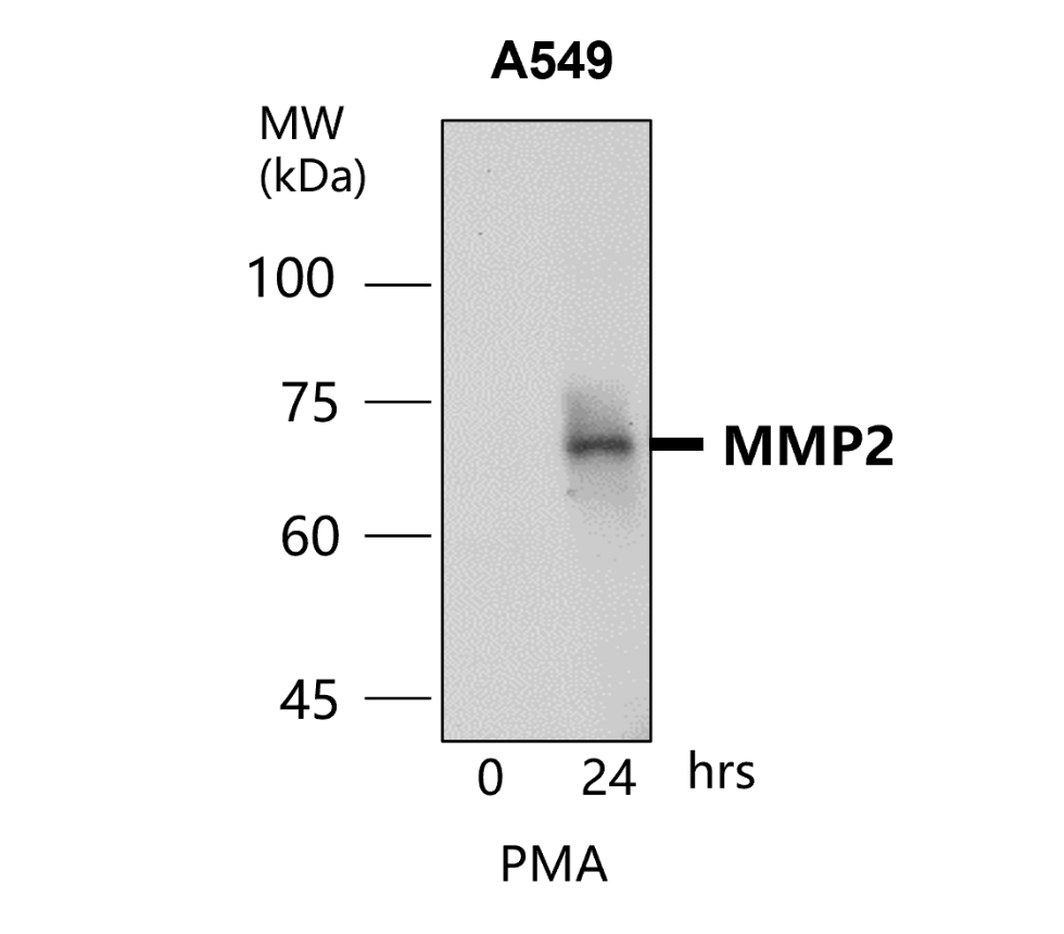 MMP2 Antibody