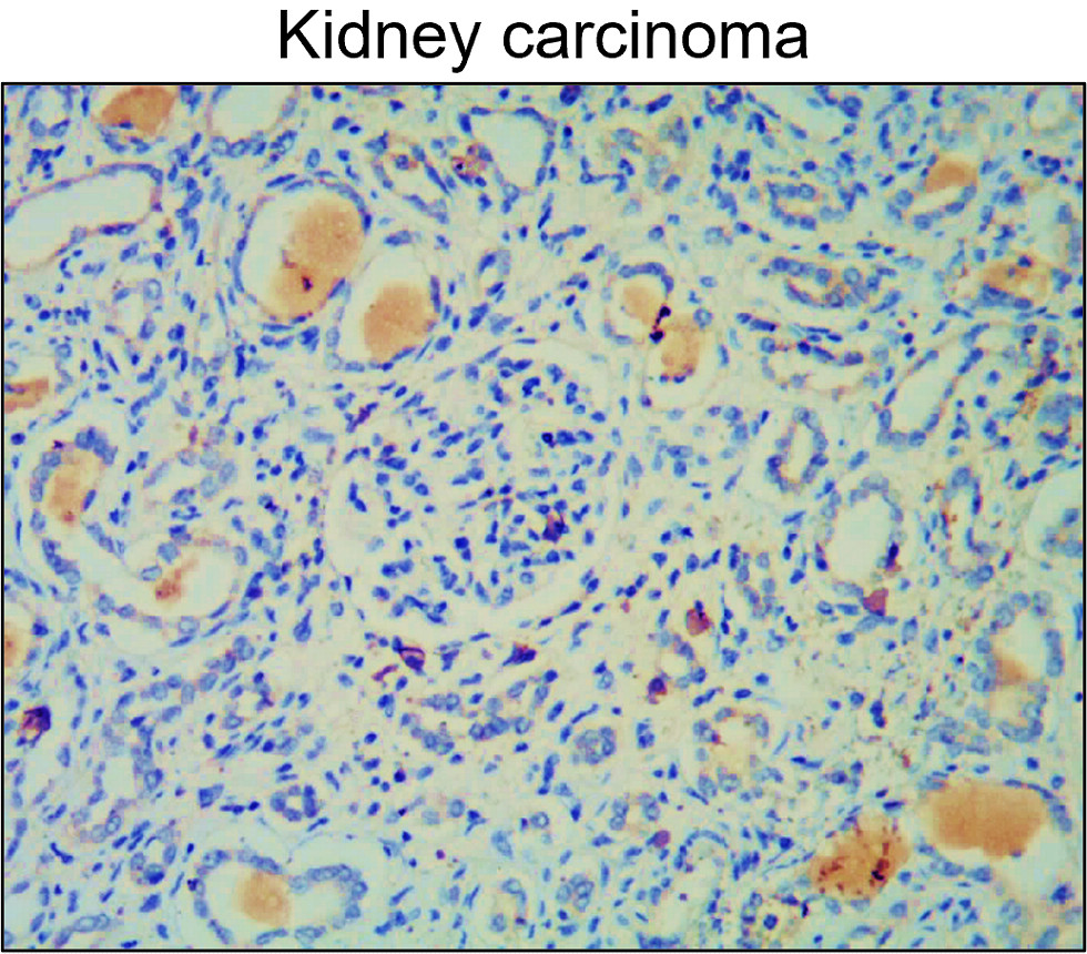 MMP2 Antibody