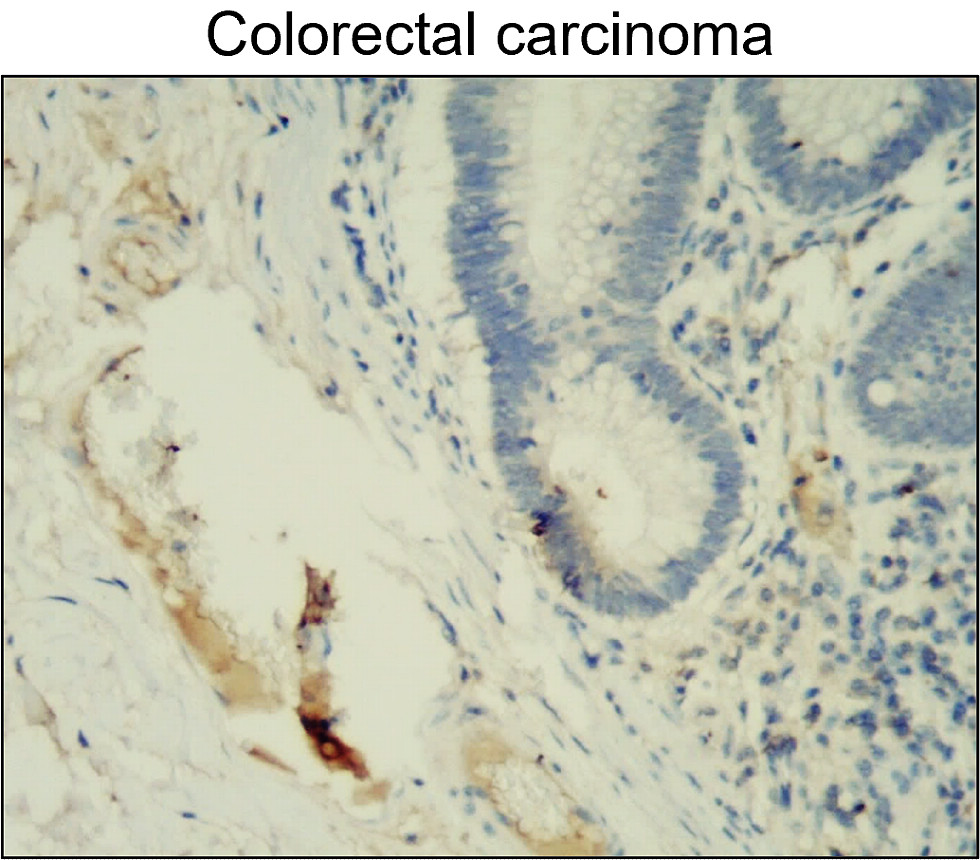 MMP2 Antibody