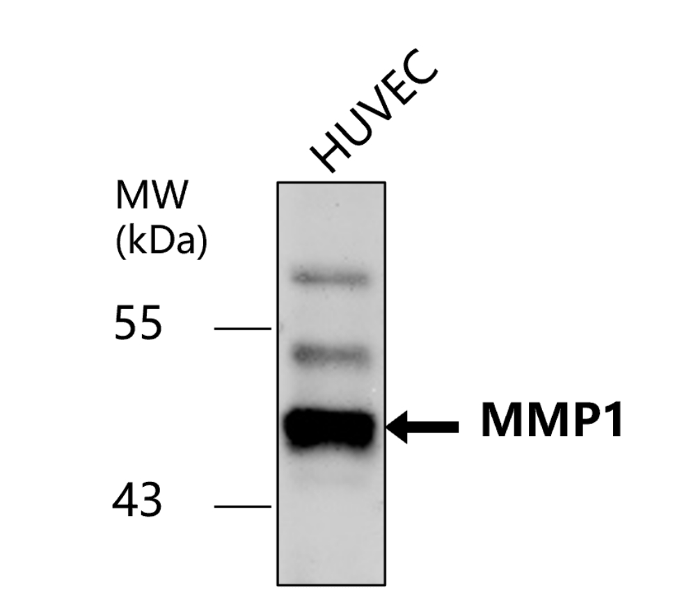 MMP1 Antibody