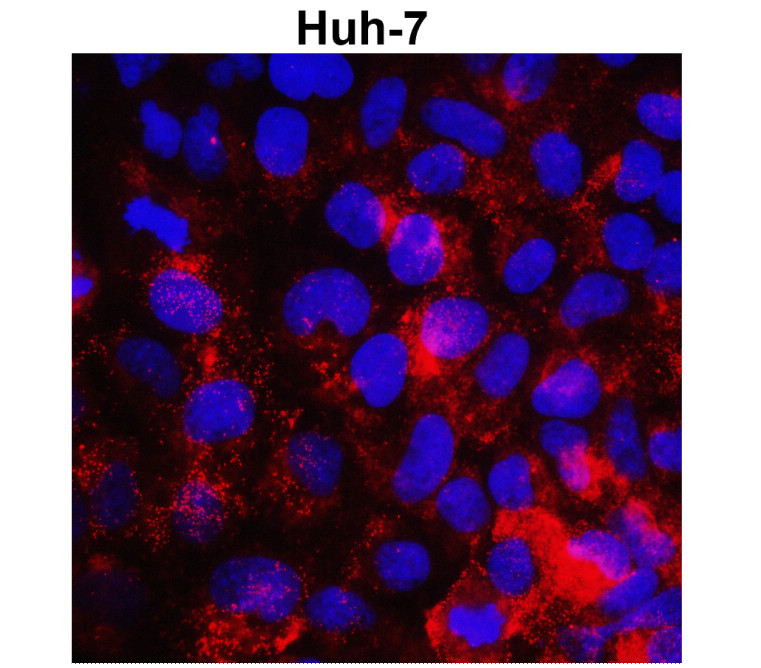 MMP1 Antibody